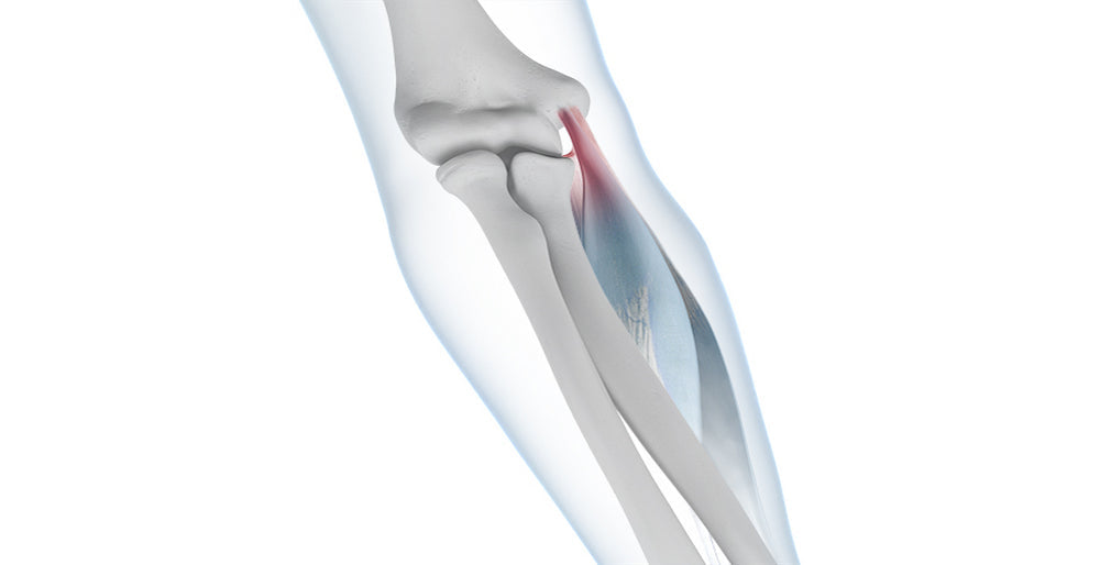 Golfer's Elbow - Bauerfeind United Kingdom