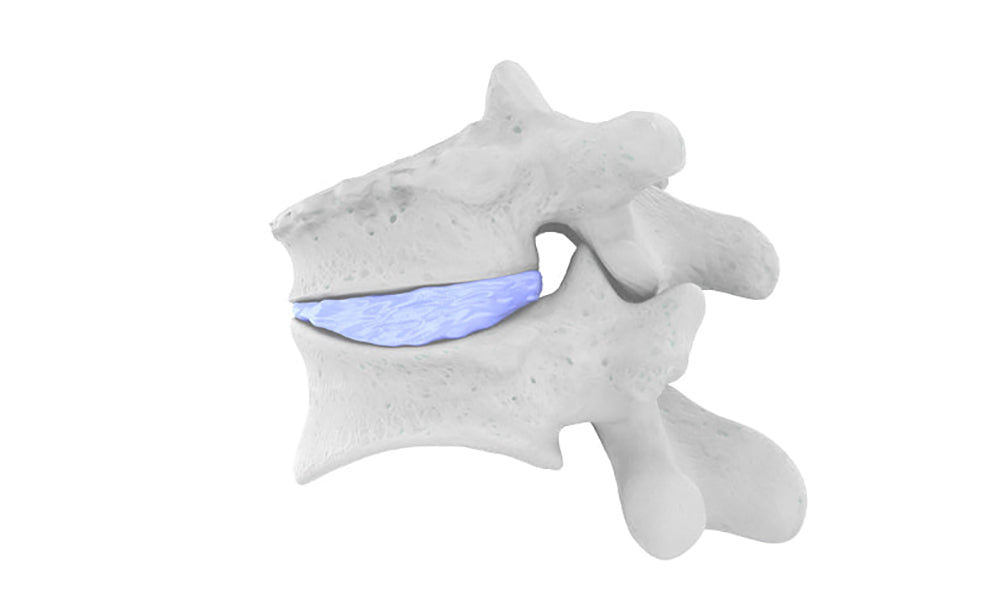 Vertebral Compression Fractures - Bauerfeind United Kingdom